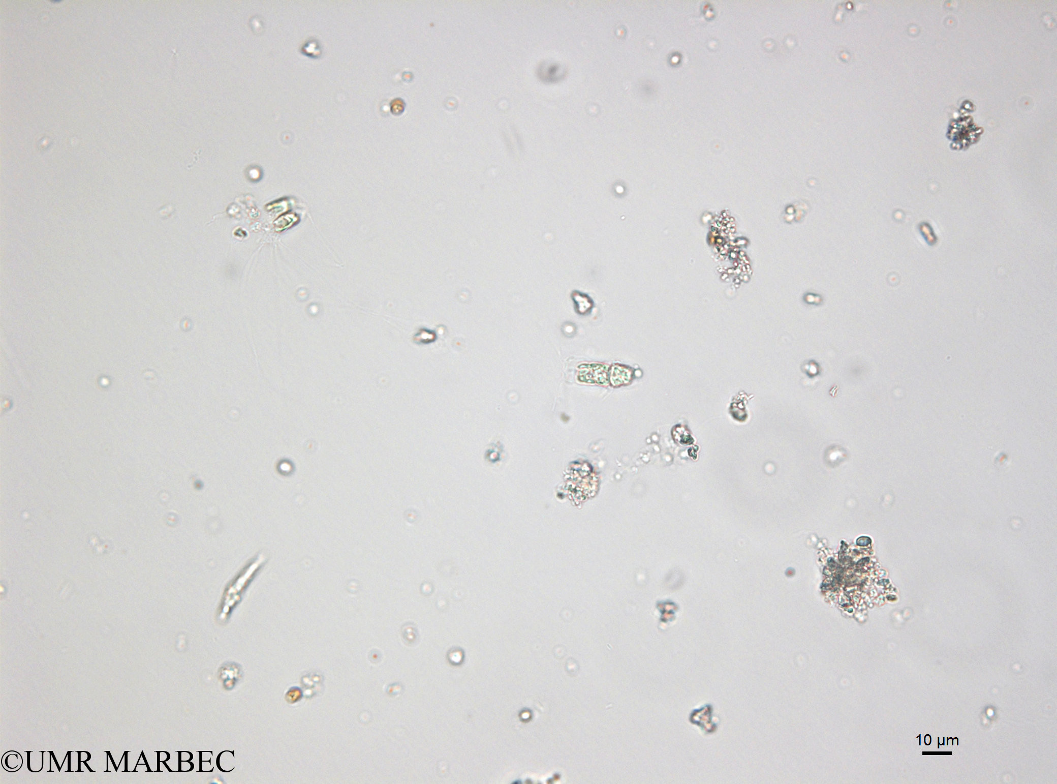 phyto/Bizerte/bizerte_bay/RISCO April 2014/Bacteriastrum sp10 (ancien B. sp4 -150109_001_ovl-4)(copy).jpg